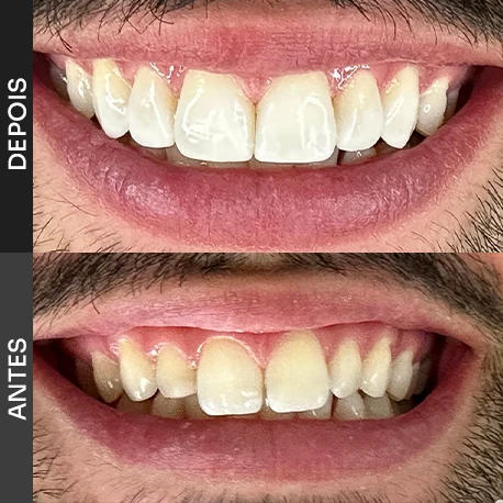 clinica medica odontologica em belo horizonte dr marcelo 12