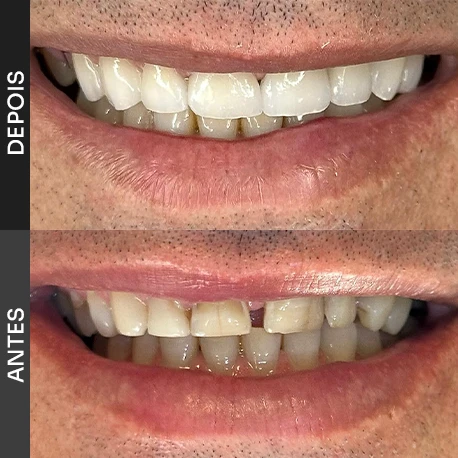 clinica medica odontologica em belo horizonte dr marcelo 6